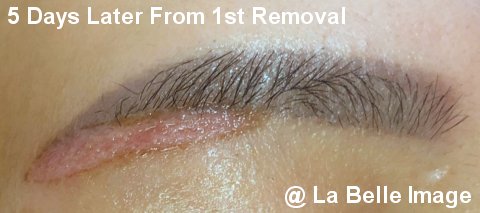 Permanent Make Up Eyebrows 5 Days Later From 1st Removal